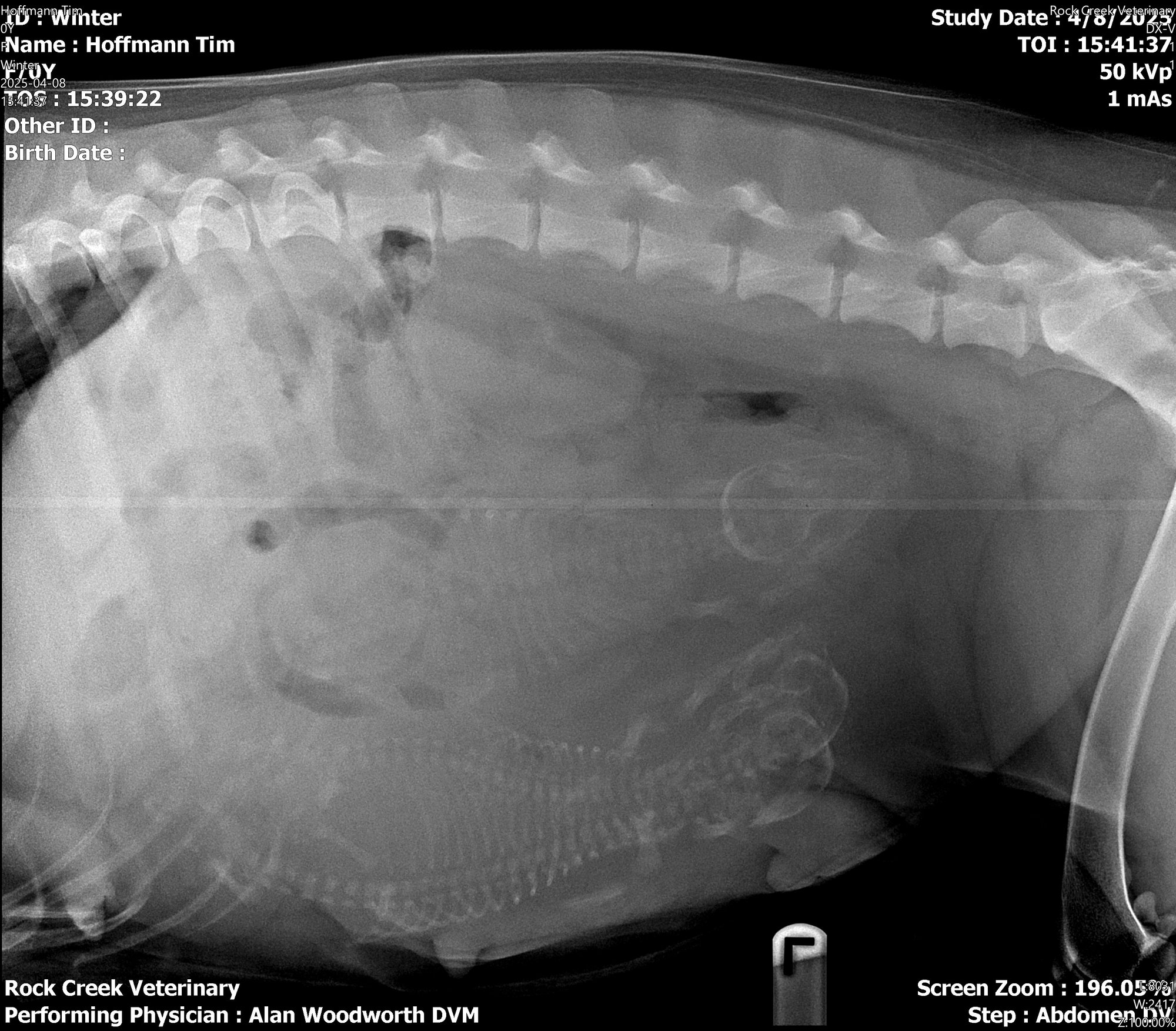 x ray 001